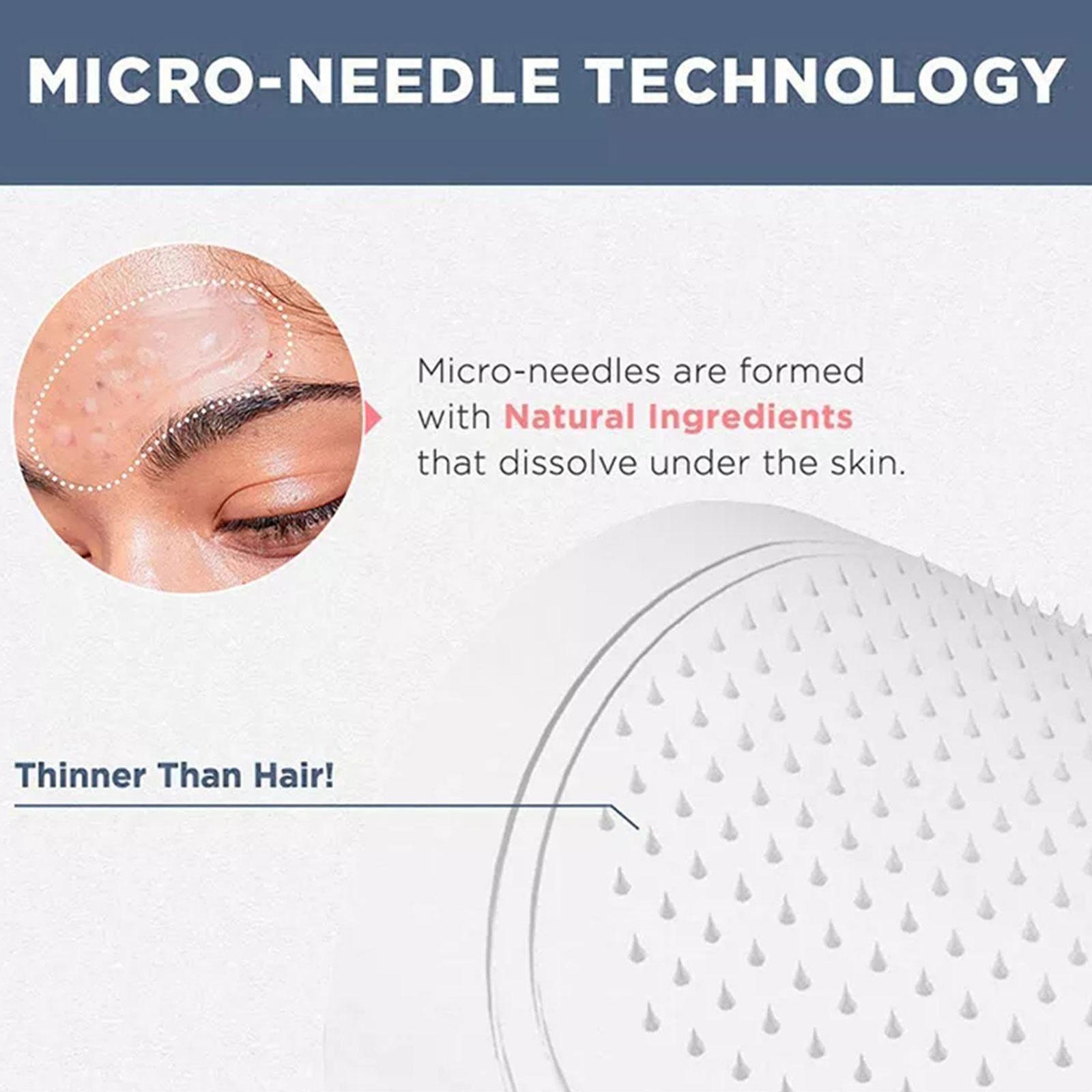 0.2mm Micro-needle Eye Patch M - Eye Pad Collagen recensie en prijs